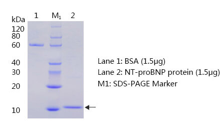 N端腦鈉肽前體（NT-proBNP）抗原SDS-PAGE圖