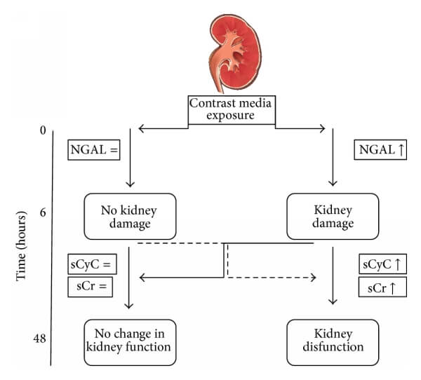 CysC與NGAL、Cr的關(guān)系